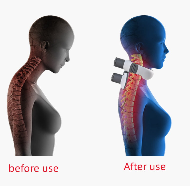 Moxa Neck Moxibustion Device Cervical Vertebra Massage